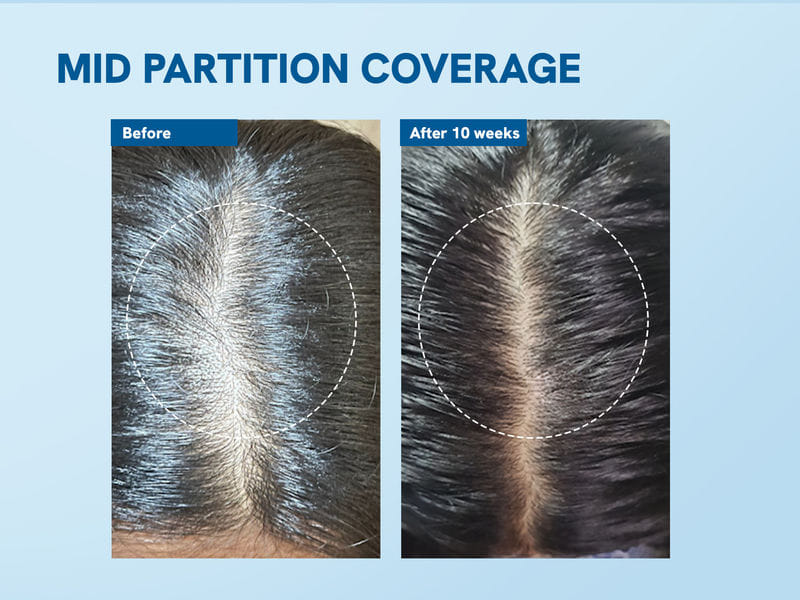 Buy Hair Growth Pack For Women - Bodywise