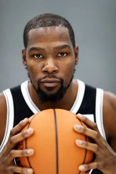 Is Kevin Durant balding?