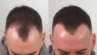 THICK FIBER Hair Building Fibers
