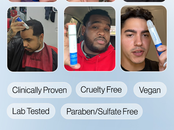 Amazon.com : Be Bodywise Rosemary Hair Growth Serum Roll On ...